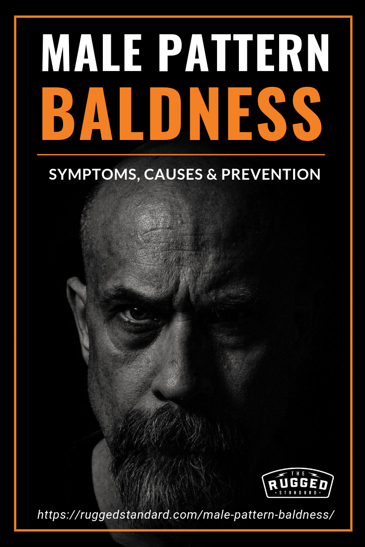Male Pattern Baldness | Symptoms, Causes And Prevention https://ruggedstandard.com/male-pattern-baldness/